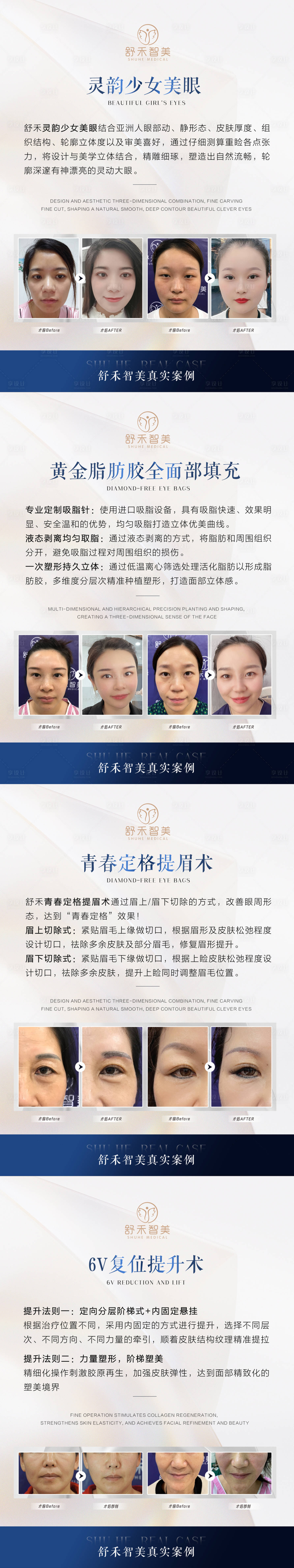 源文件下載【享設計】搜索編號：98220007106824169【醫美品相案例介紹系列海報】
