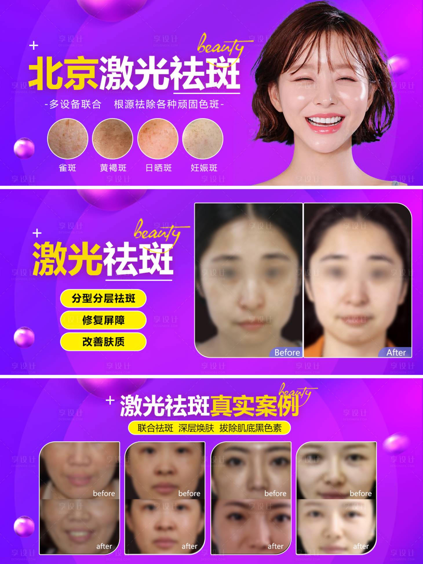 源文件下載【享設(shè)計】搜索編號：69740007160773690【激光祛斑banner案例輪播圖】
