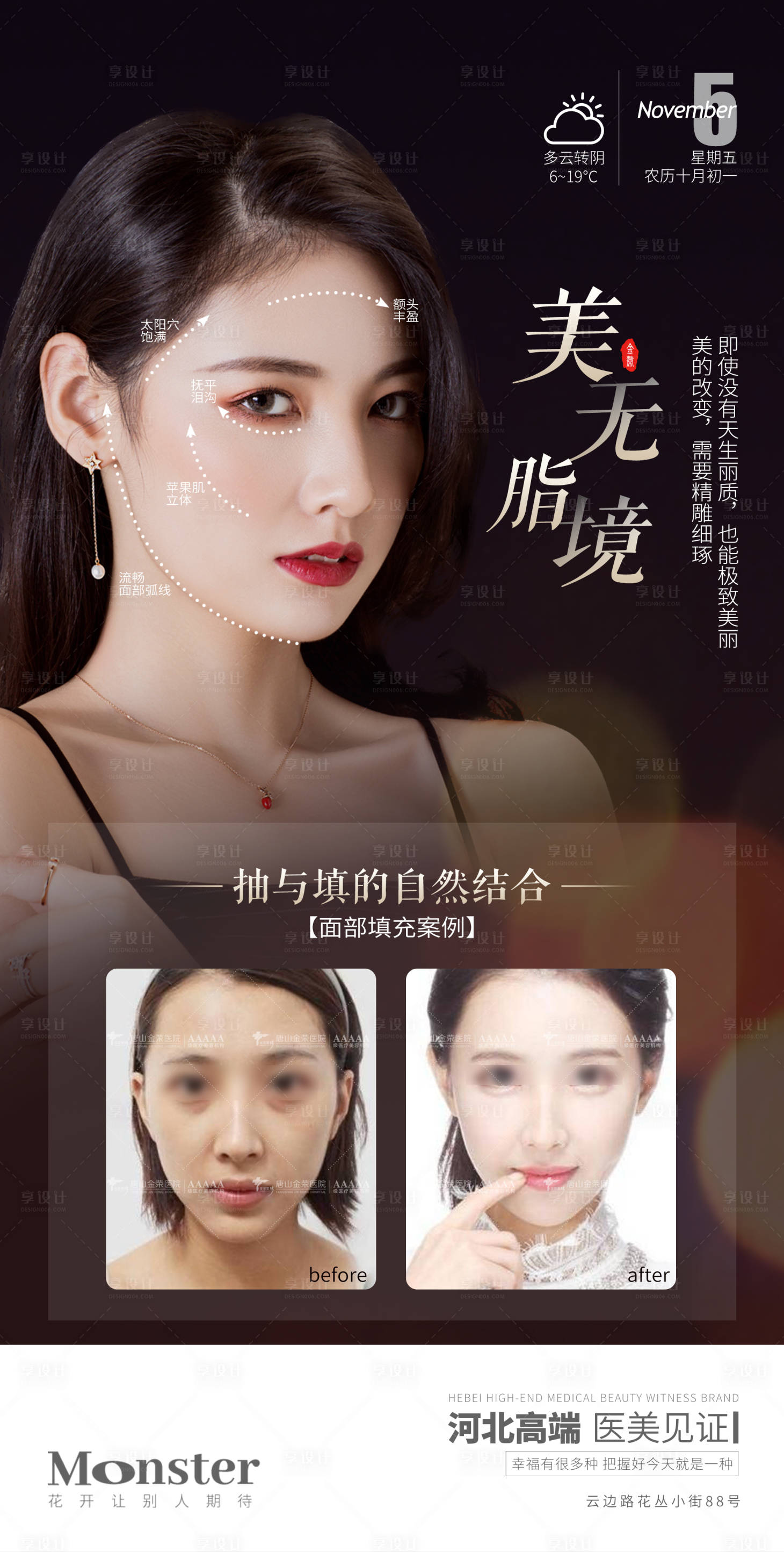 源文件下載【享設(shè)計(jì)】搜索編號：40280007913963157【醫(yī)美吸脂海報(bào)】