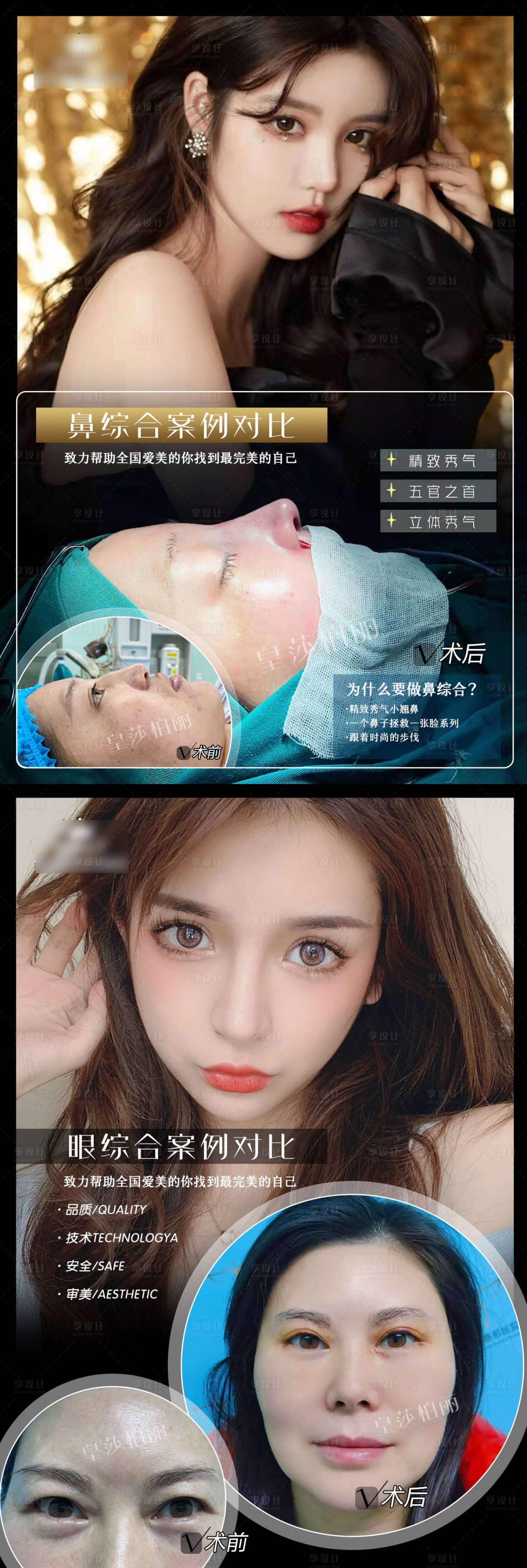 源文件下载【享设计】搜索编号：81720007532968955【医美案例整形海报】