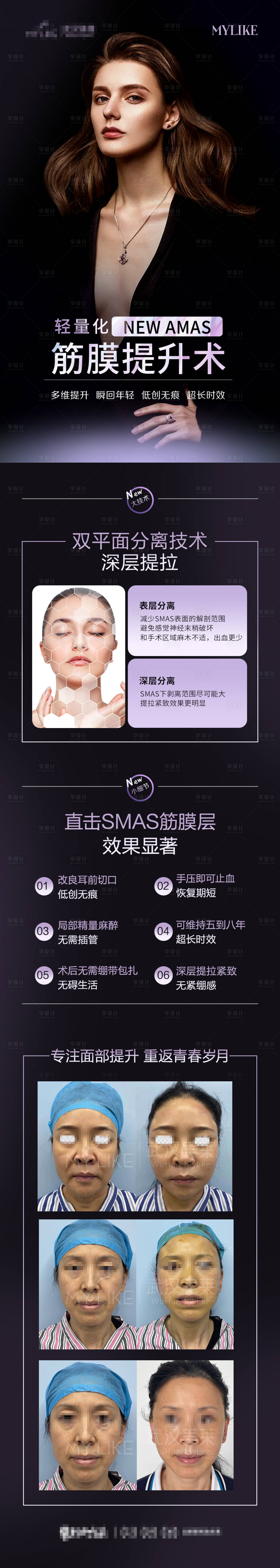源文件下載【享設(shè)計】搜索編號：74130007461505892【超聲刀詳情 】