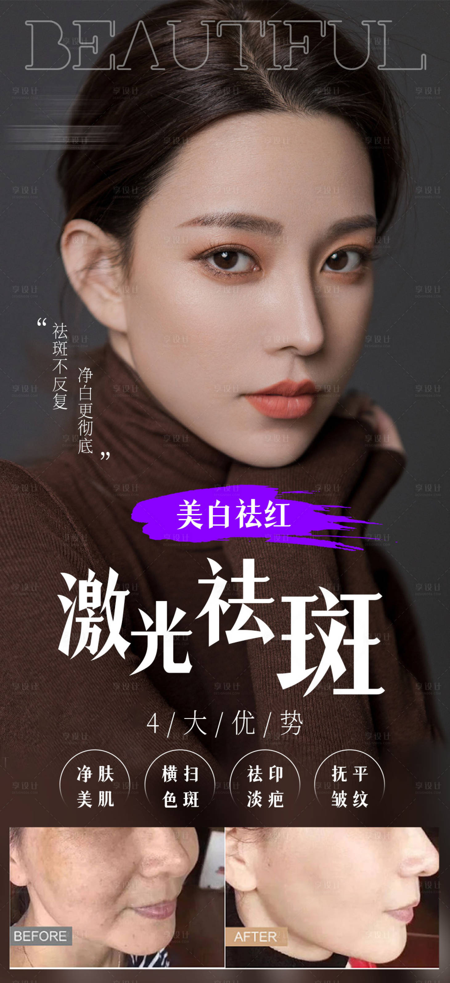 源文件下载【享设计】搜索编号：65620007492559308【医美祛斑案例海报】