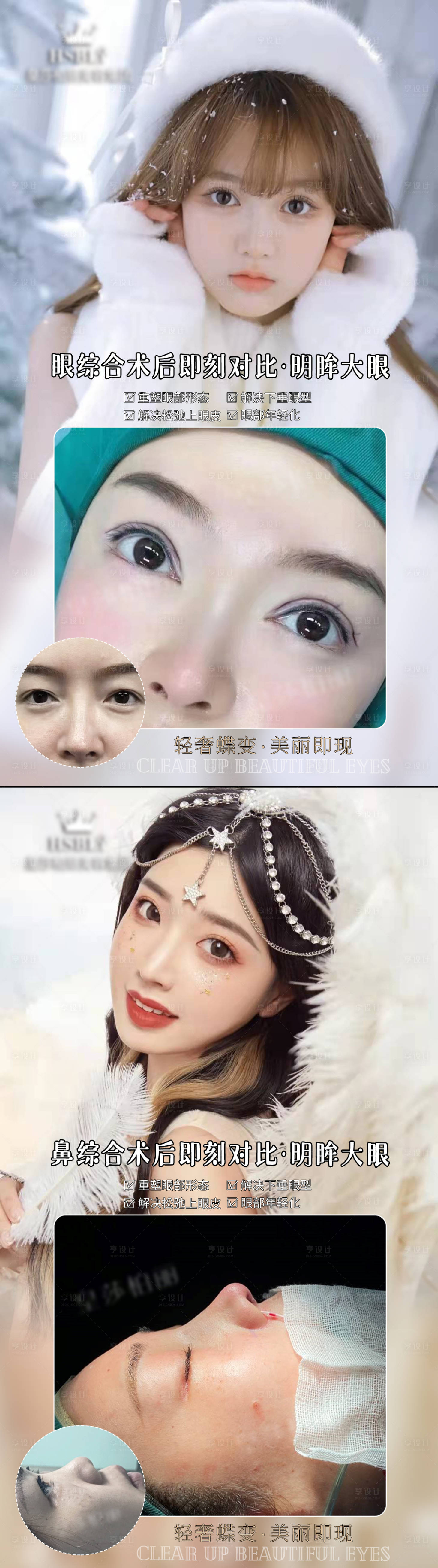 源文件下载【享设计】搜索编号：62650007850327763【医美案例】