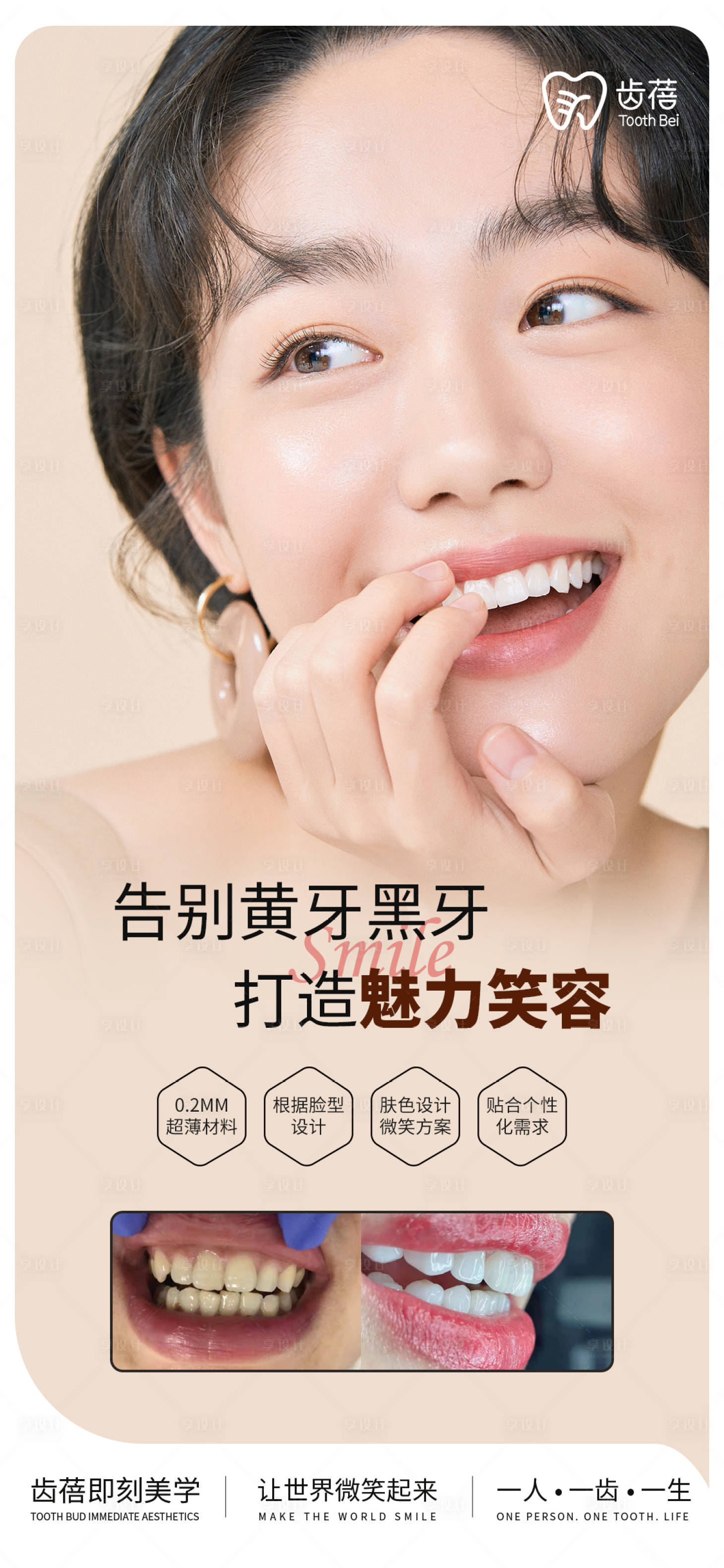 源文件下載【美業(yè)設(shè)計(jì) 牙齒海報(bào)設(shè)計(jì) 貼面 口腔】編號：79380007826869945