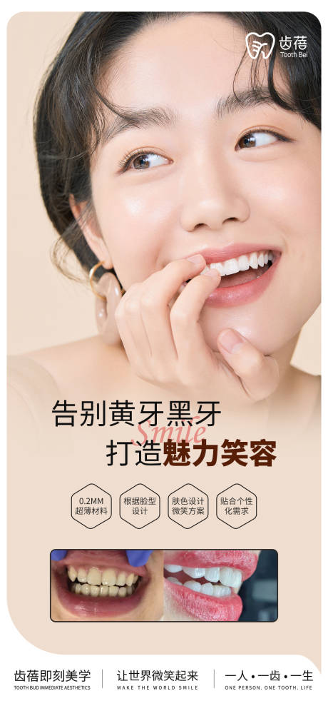 美业设计 牙齿海报设计 贴面 口腔-源文件【享设计】