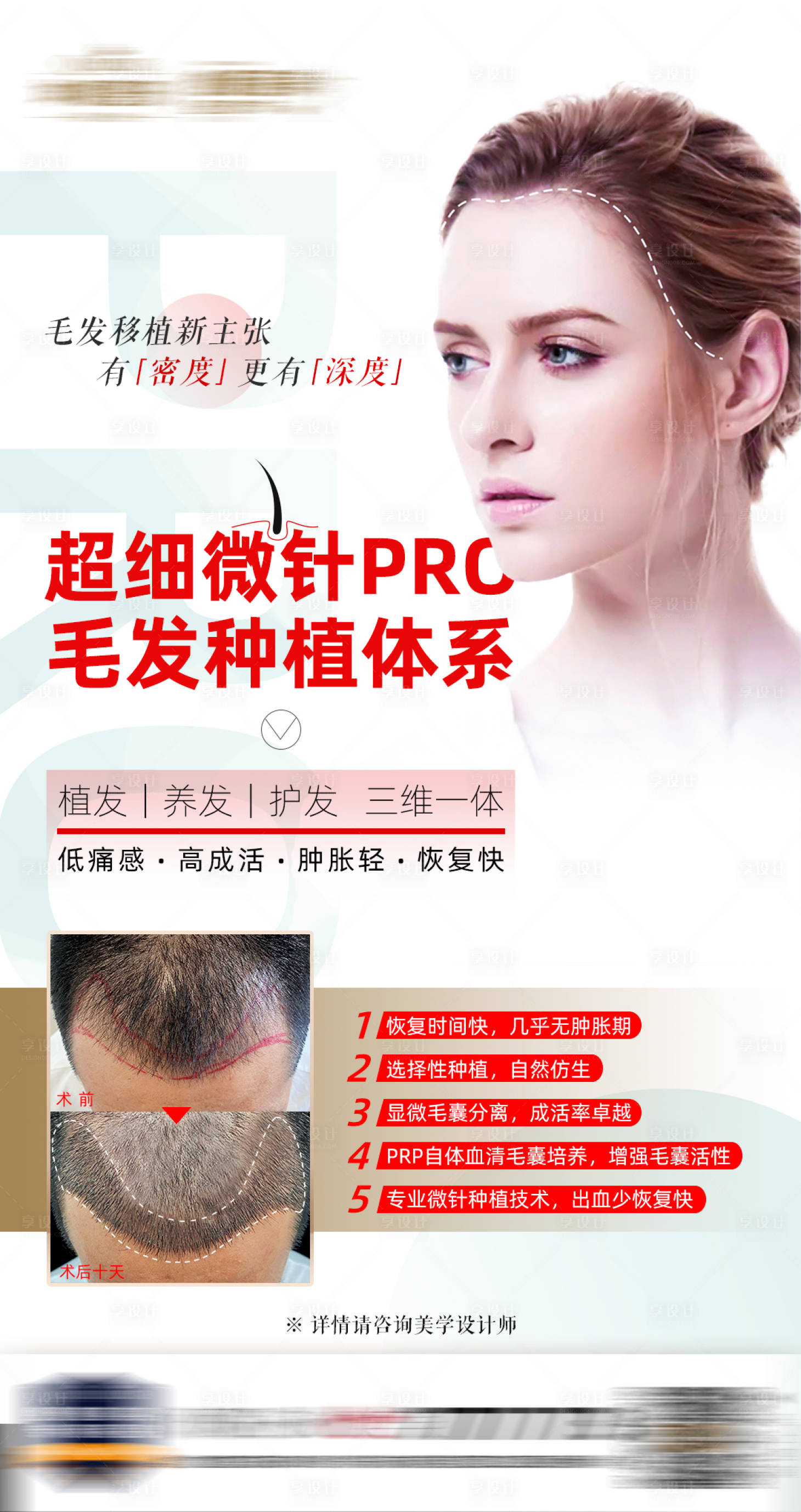 源文件下载【享设计】搜索编号：73980007566053986【医美植发海报】