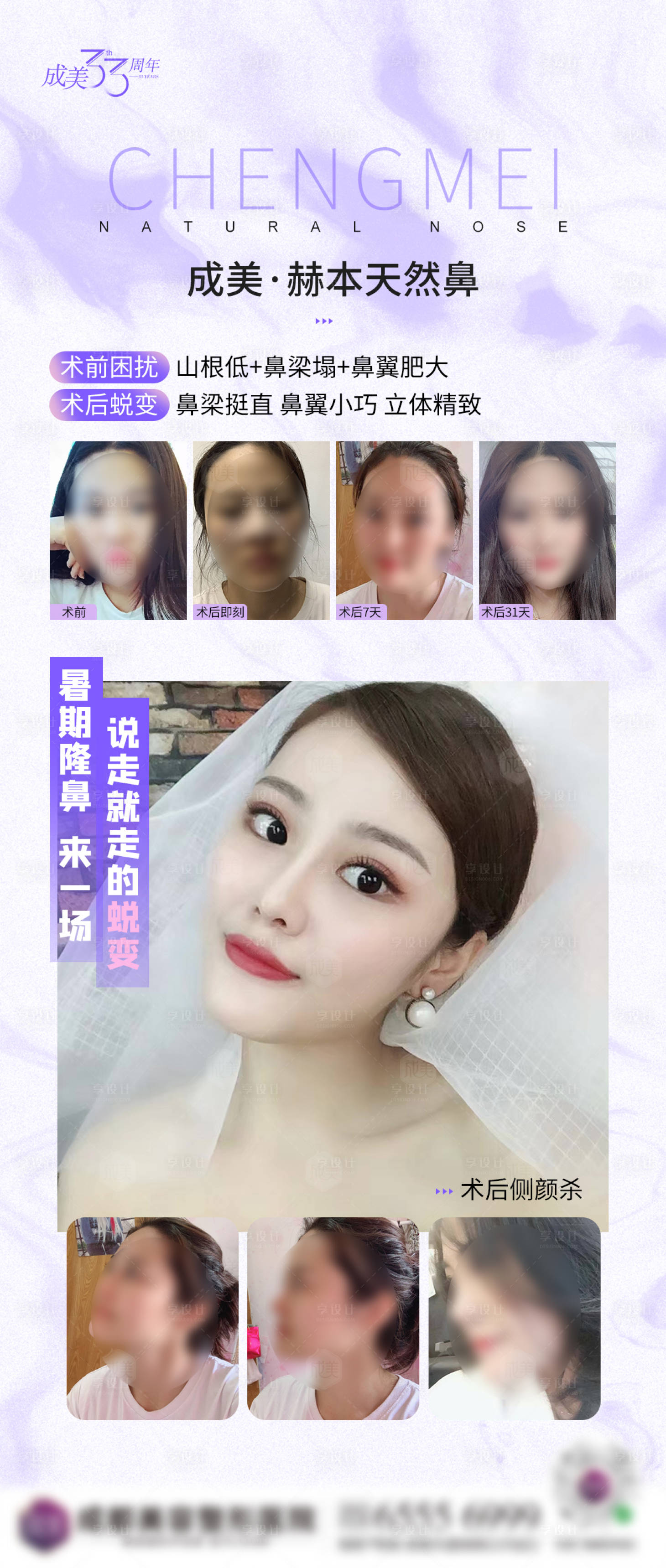 源文件下载【鼻部案例整形海报】编号：21090007547675745