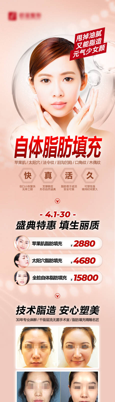 源文件下载【脂肪填充】编号：17520007796379886