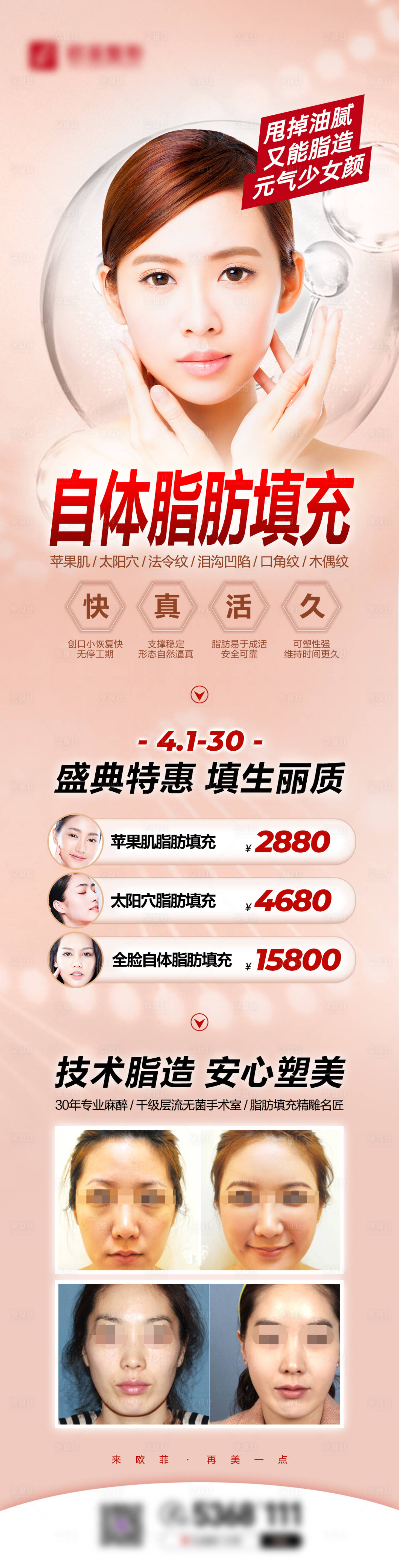 源文件下载【享设计】搜索编号：17520007796379886【脂肪填充】