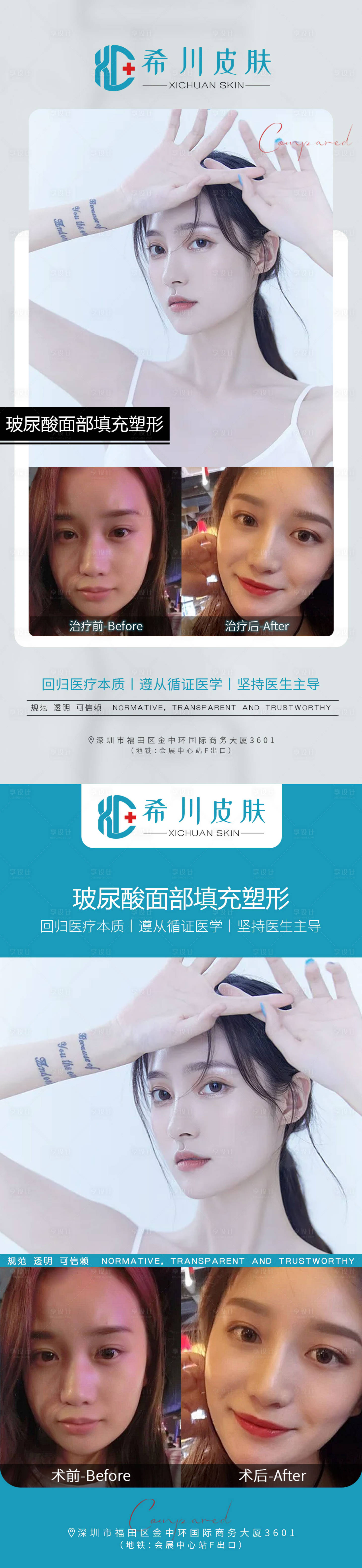 源文件下载【医美案例对比】编号：95110007635938605