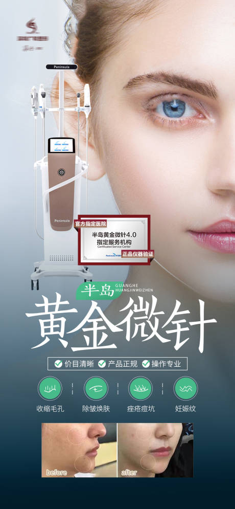 源文件下载【医美半岛黄金微针仪器海报】编号：30810007748847894