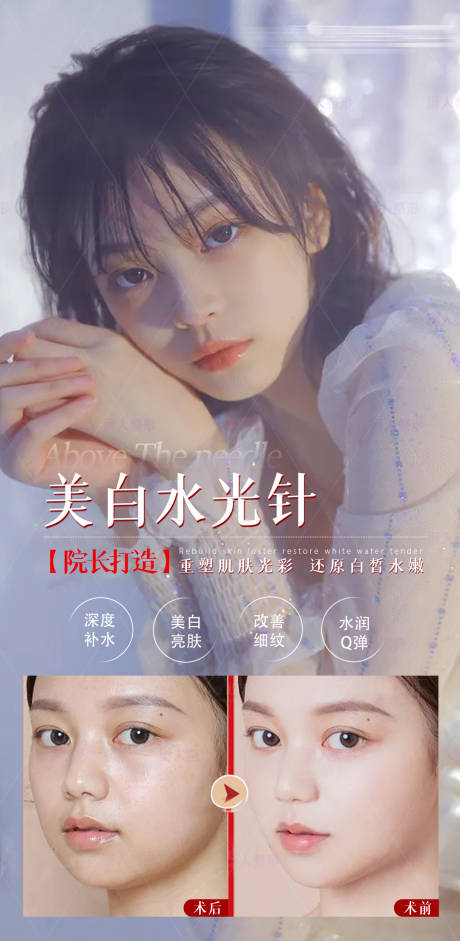 源文件下载【医美水光针案例】编号：15280007492754153