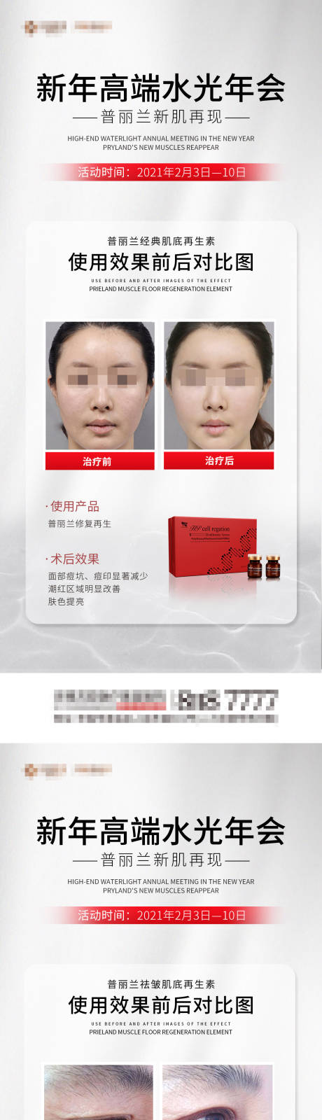 源文件下载【享设计】搜索编号：22590007671583783【医美整形案列系列海报】