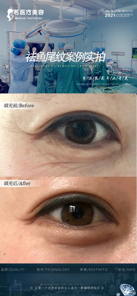 源文件下载【医美眼综合】编号：98470007598036200