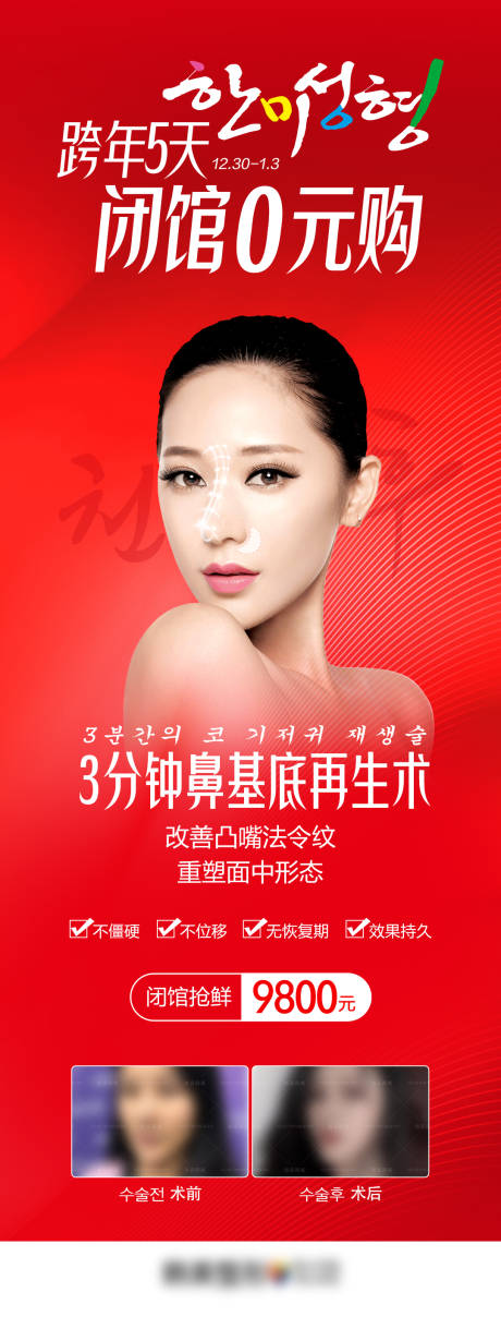 源文件下载【医美鼻整形隆鼻鼻基底再生术】编号：93310007816555569