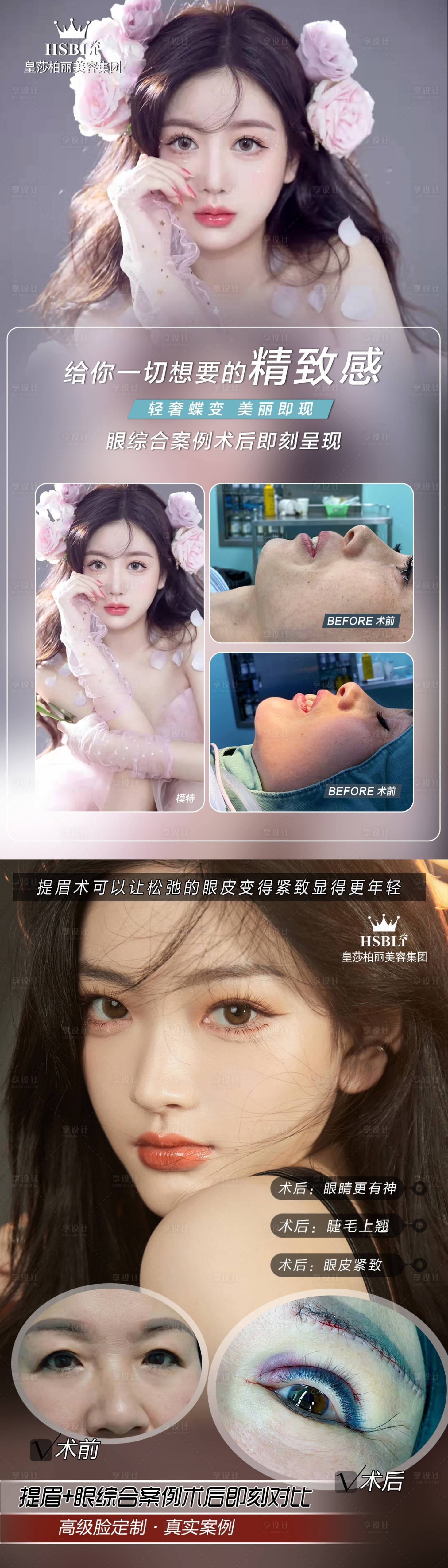 源文件下载【医美案例提眉海报】编号：84190007574175877
