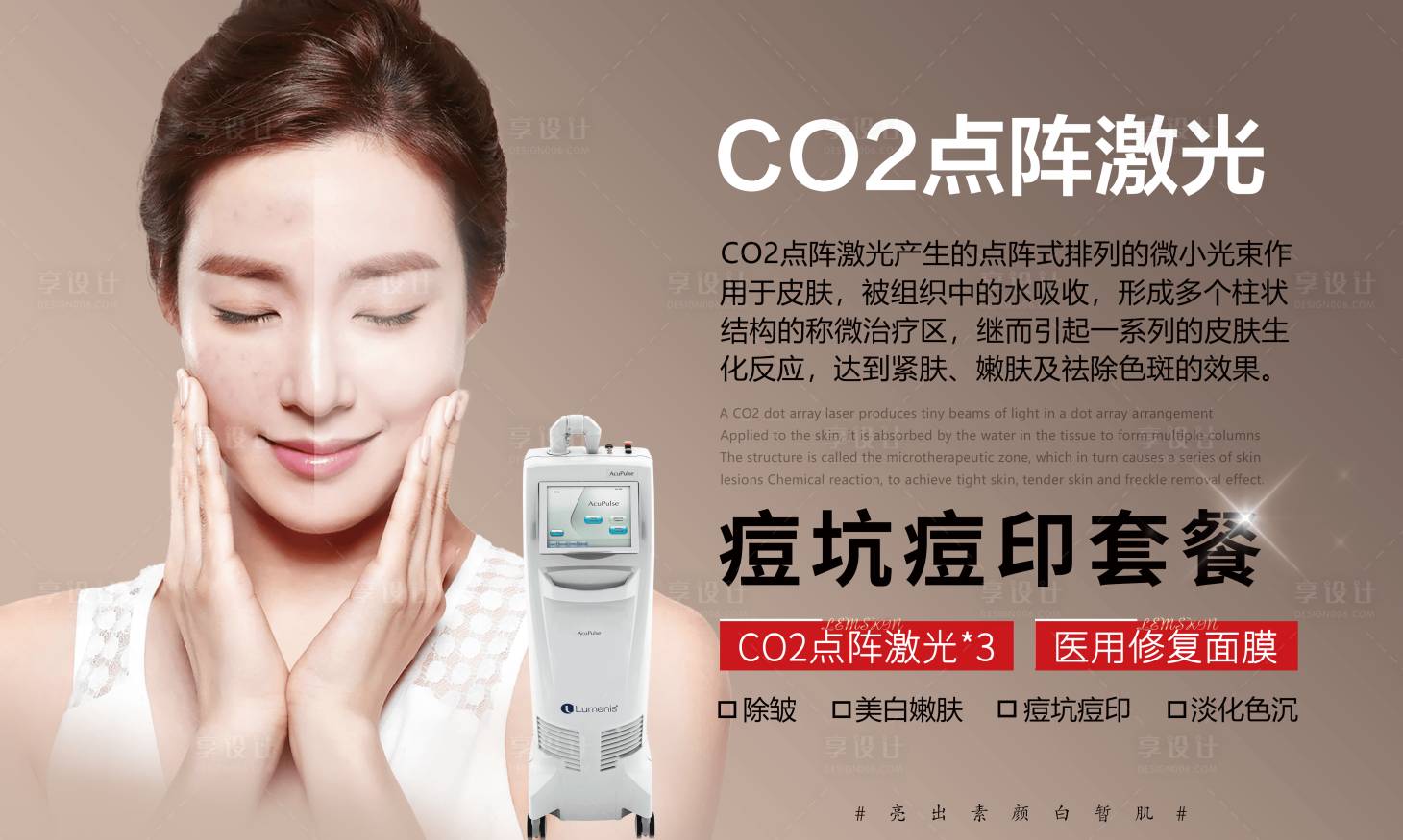源文件下载【CO2点阵激光】编号：58570007569385700
