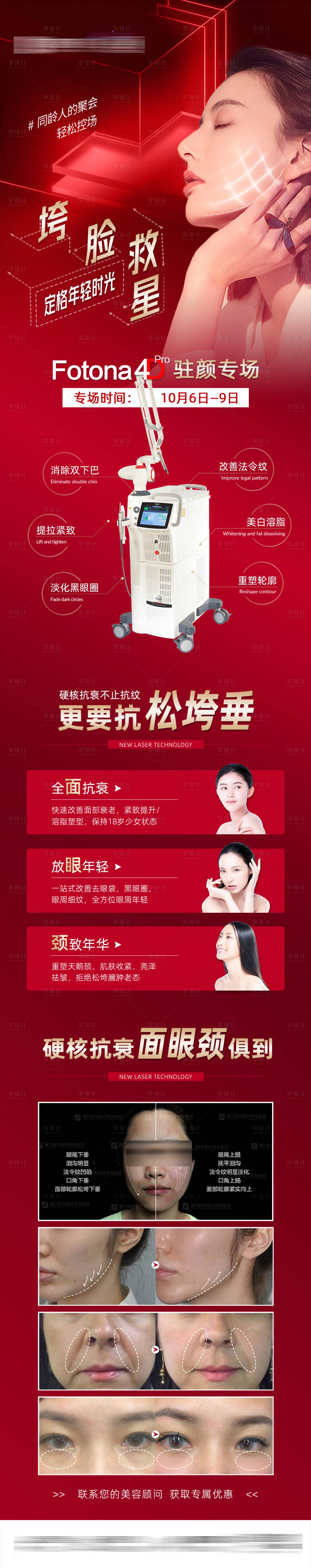 源文件下载【fotona4D长图】编号：88330007582094466