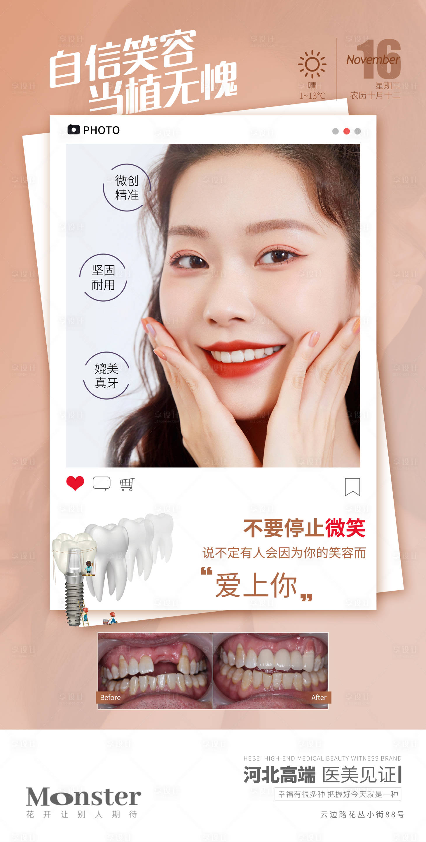 源文件下載【享設計】搜索編號：54180007914235116【醫美口腔種植牙海報】