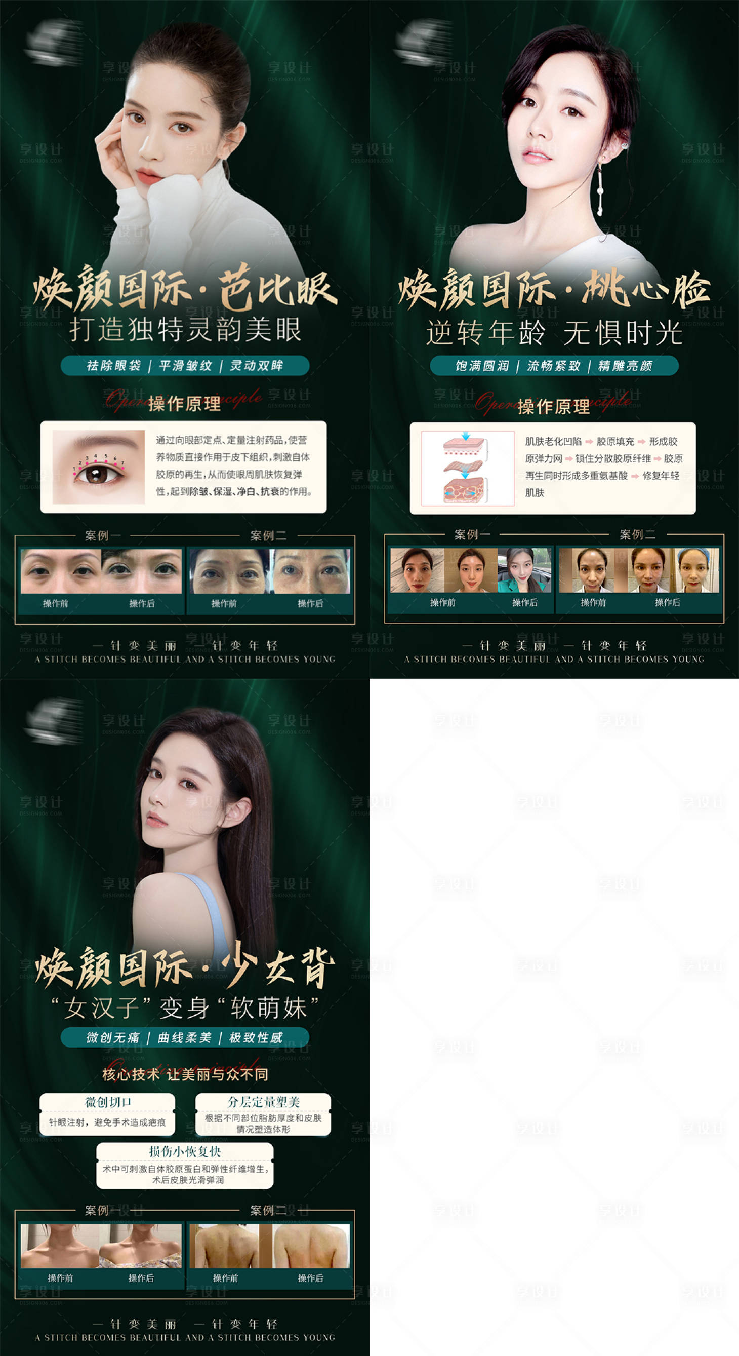 源文件下载【享设计】搜索编号：91980007678694510【医美骨雕系列海报】
