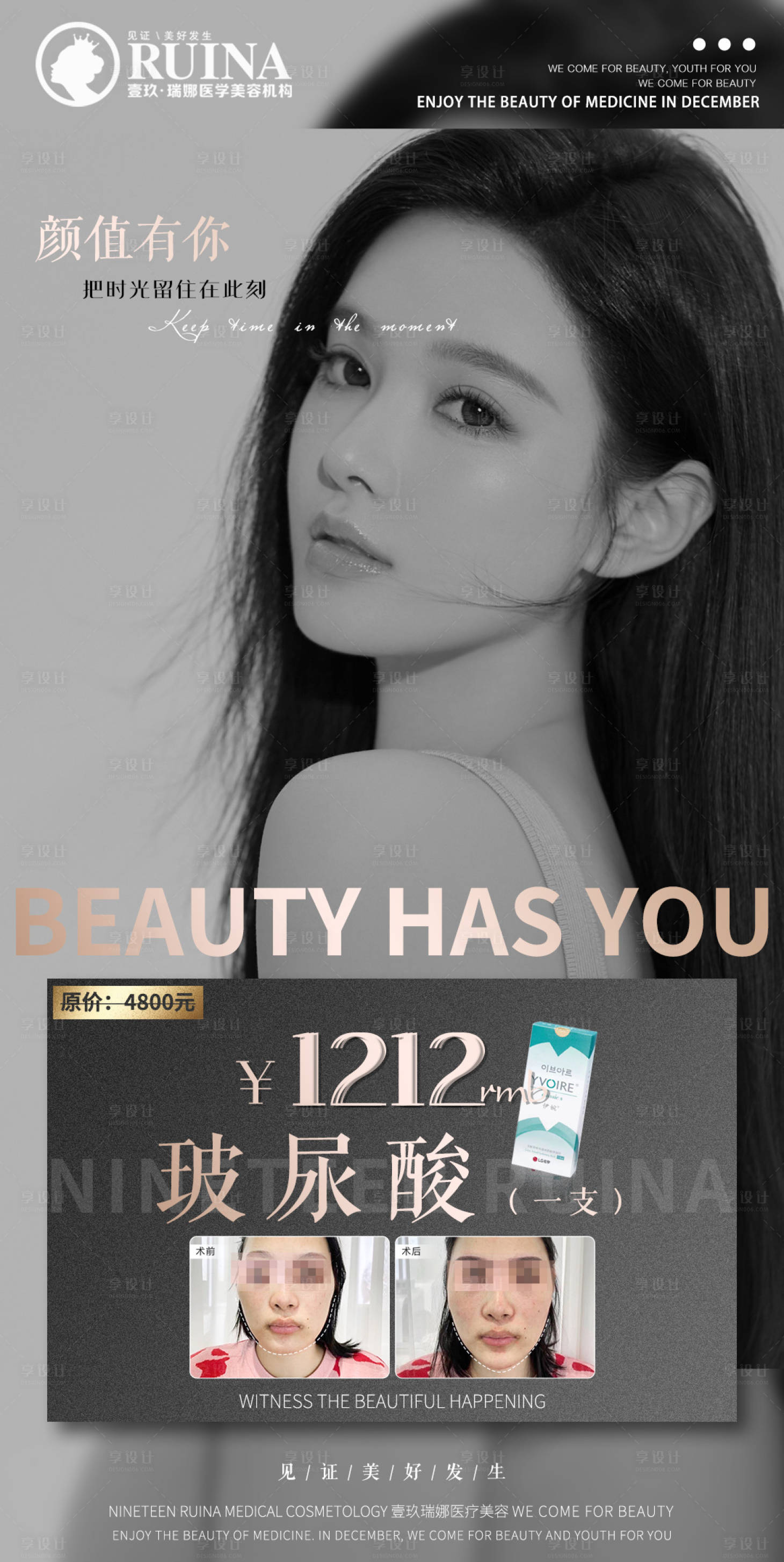 源文件下載【享設(shè)計(jì)】搜索編號：29270007575661176【醫(yī)美玻尿酸人物展架】