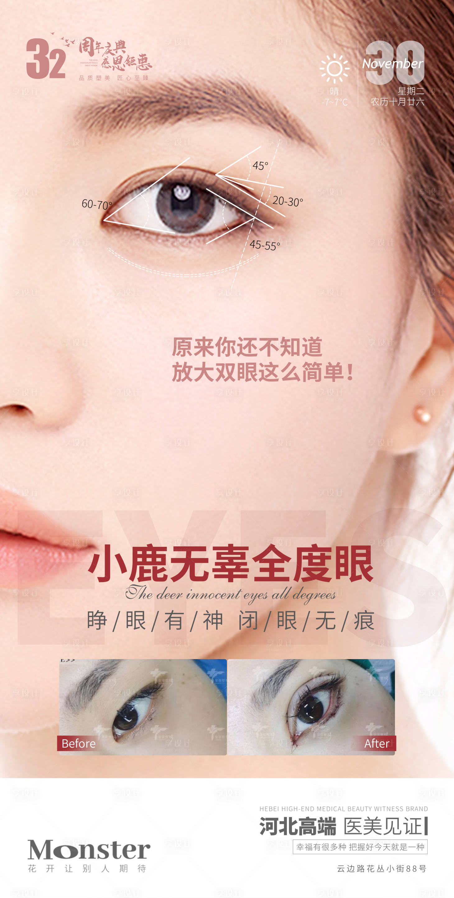 源文件下载【医美小鹿无辜全度眼海报】编号：16980007914431730