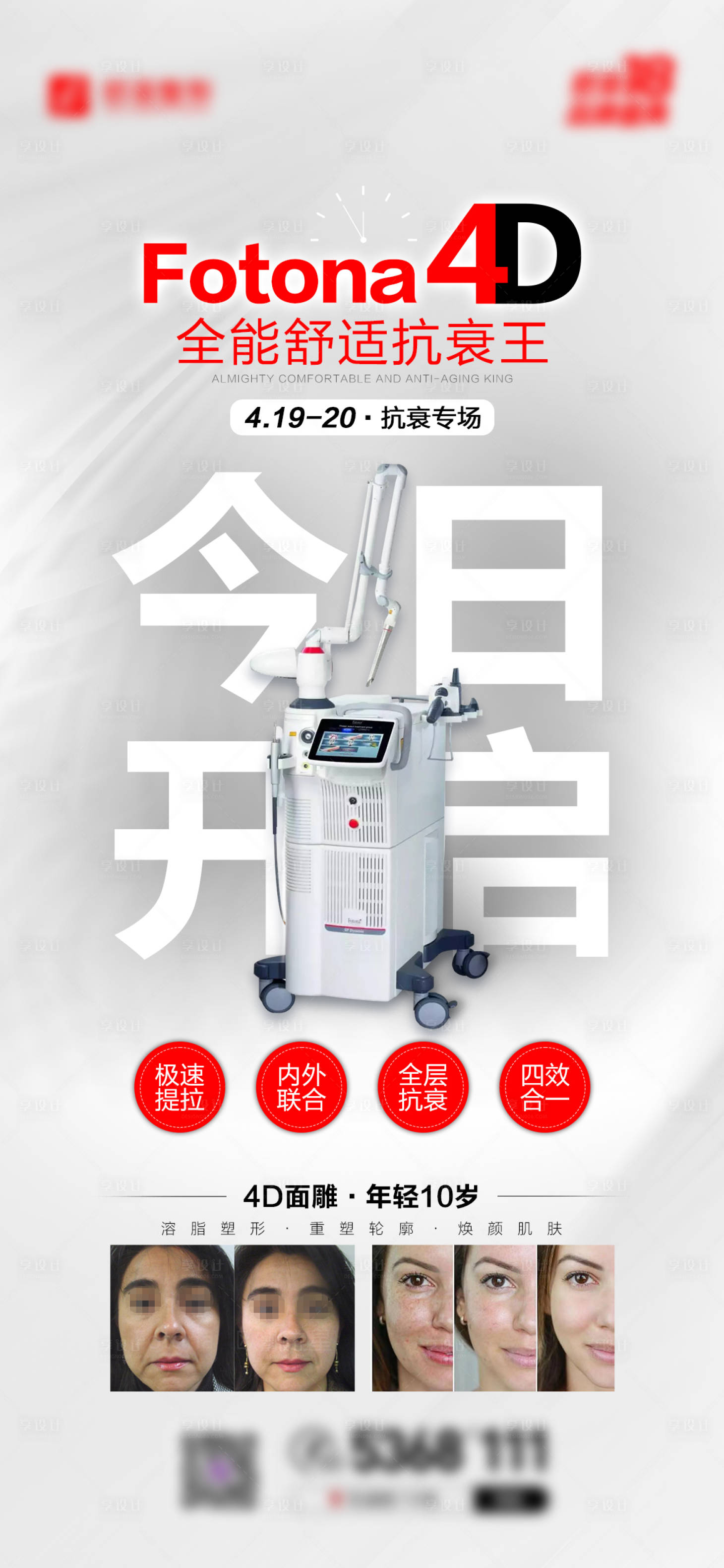 源文件下载【享设计】搜索编号：89100007815174953【fotona今日开启简约海报】