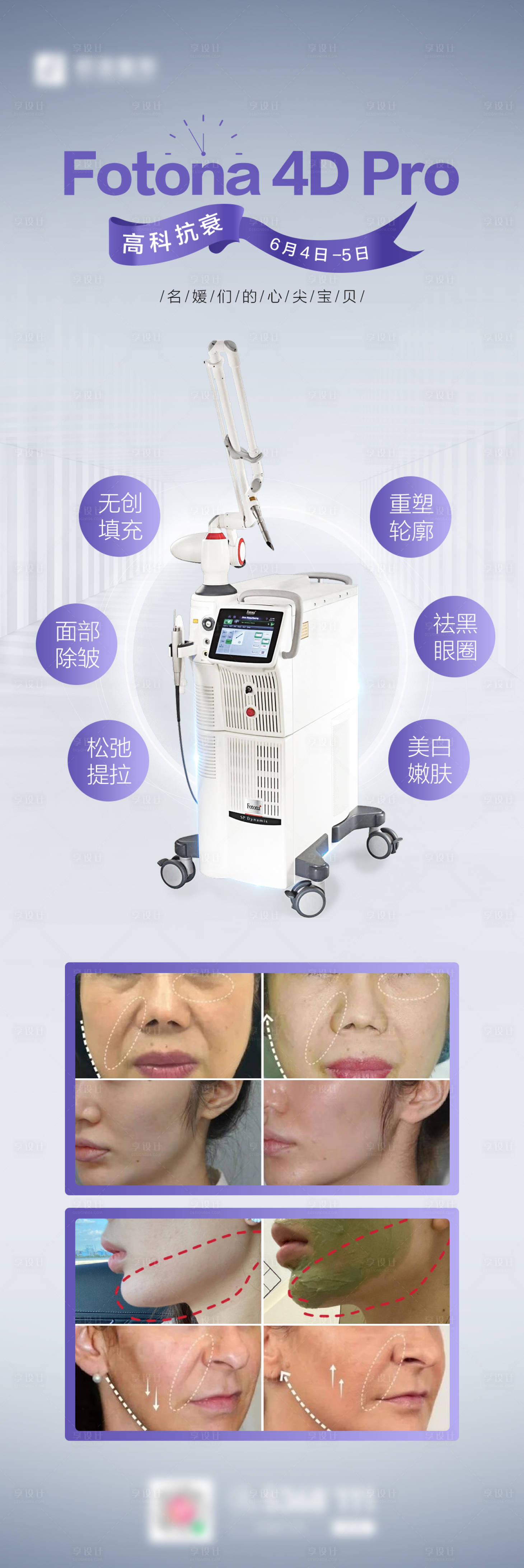 源文件下载【享设计】搜索编号：35360007815114529【FOTONA4DPRO仪器长图海报】