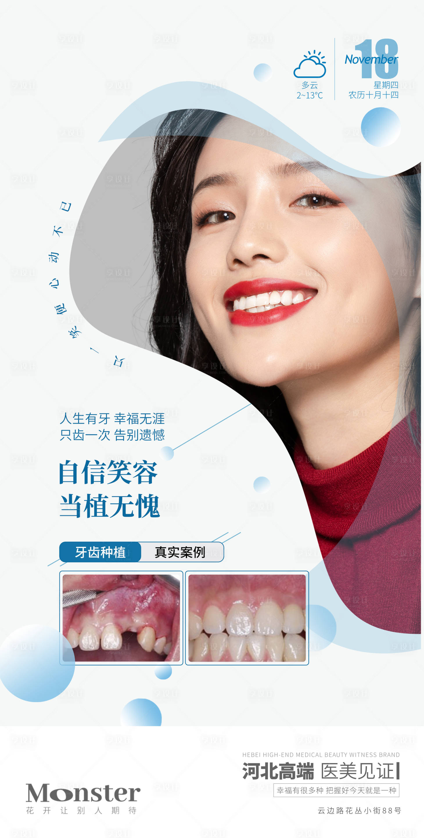 源文件下载【享设计】搜索编号：60890007914277570【医美牙齿种植海报】