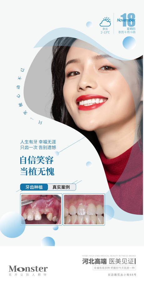 医美牙齿种植海报-源文件【享设计】