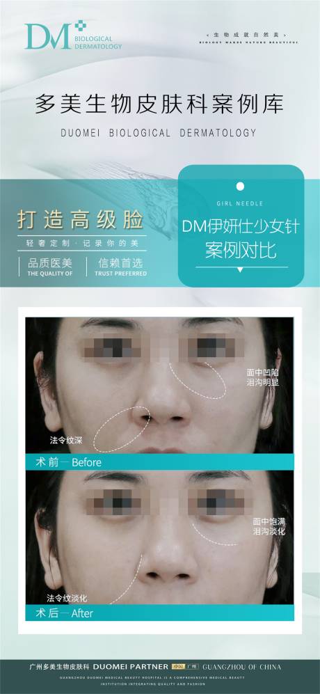 医美玻尿酸知识科普海报