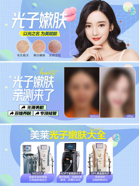 源文件下载【光子嫩肤 】编号：77870007965332032