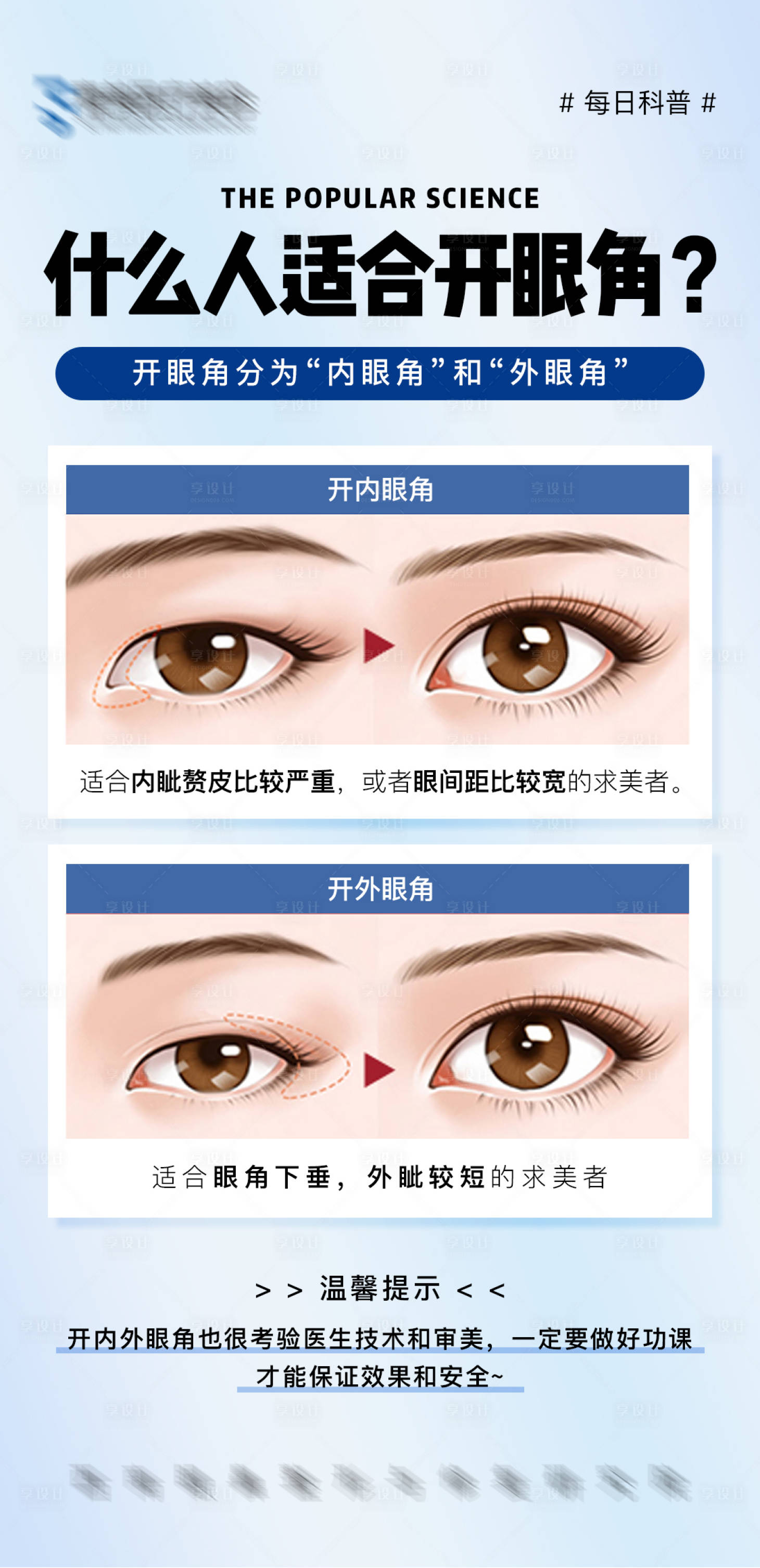 源文件下载【医美科普开眼角海报】编号：89750008247933638