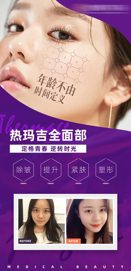 源文件下载【医美热玛吉宣传海报】编号：89900007942728131