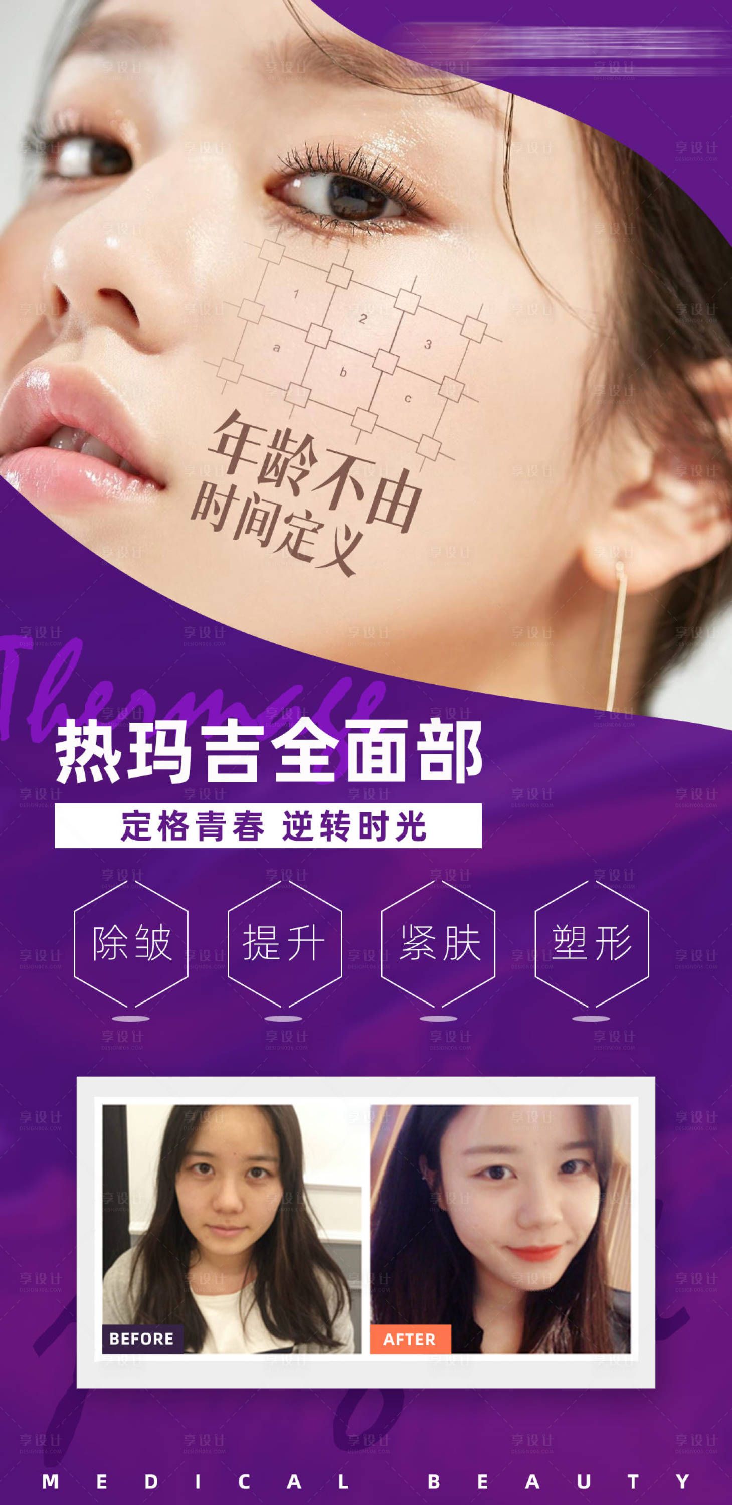 源文件下载【享设计】搜索编号：89900007942728131【医美热玛吉宣传海报】