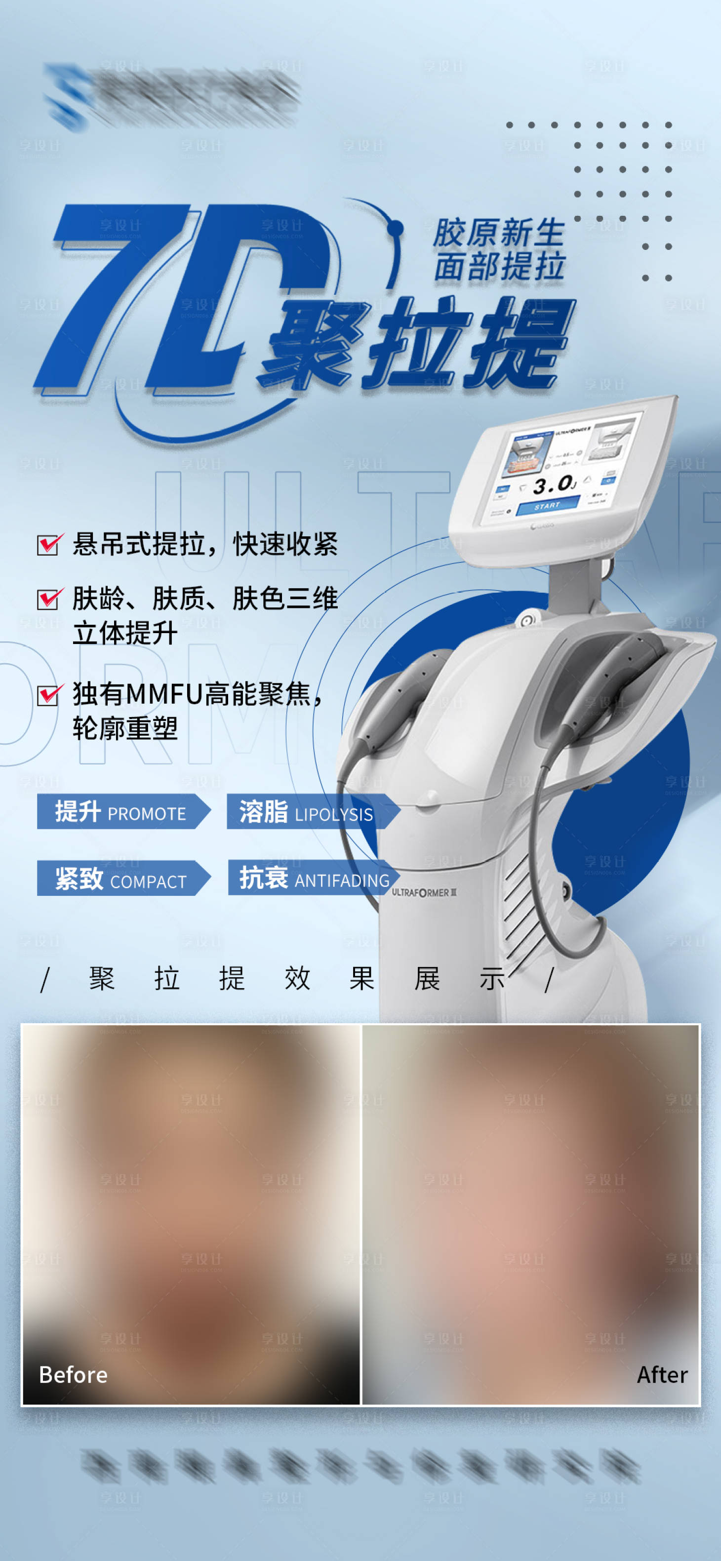 源文件下載【醫美7D聚拉提】編號：33120008248571818