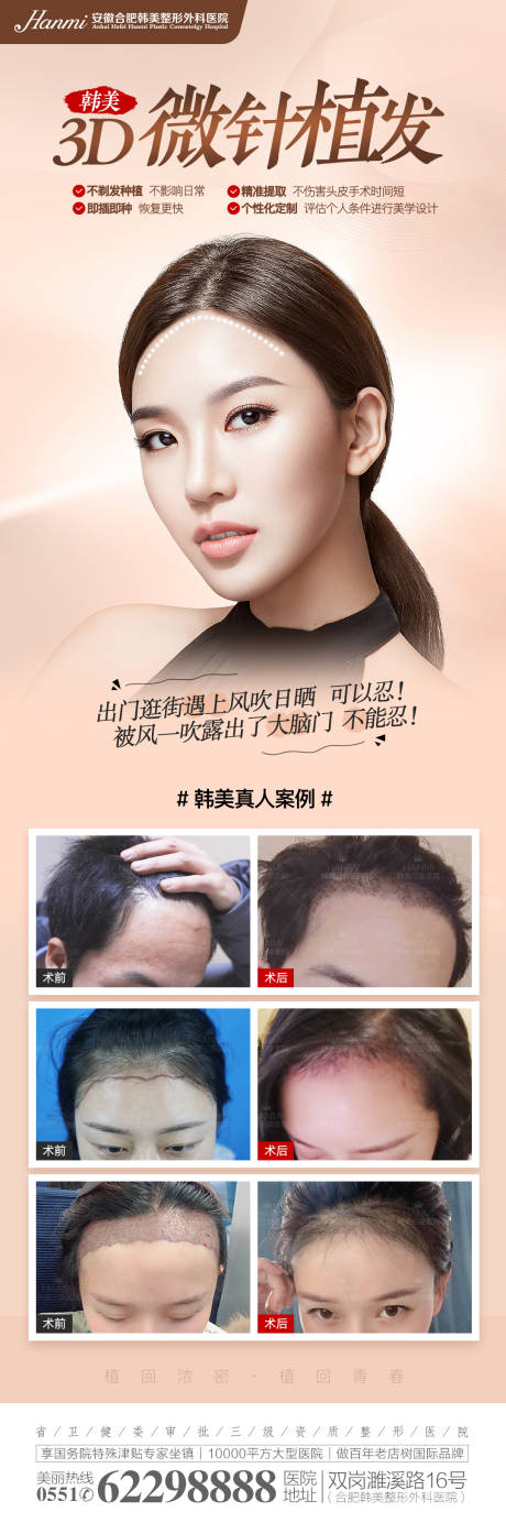 源文件下载【微针植发】编号：40400007958768974