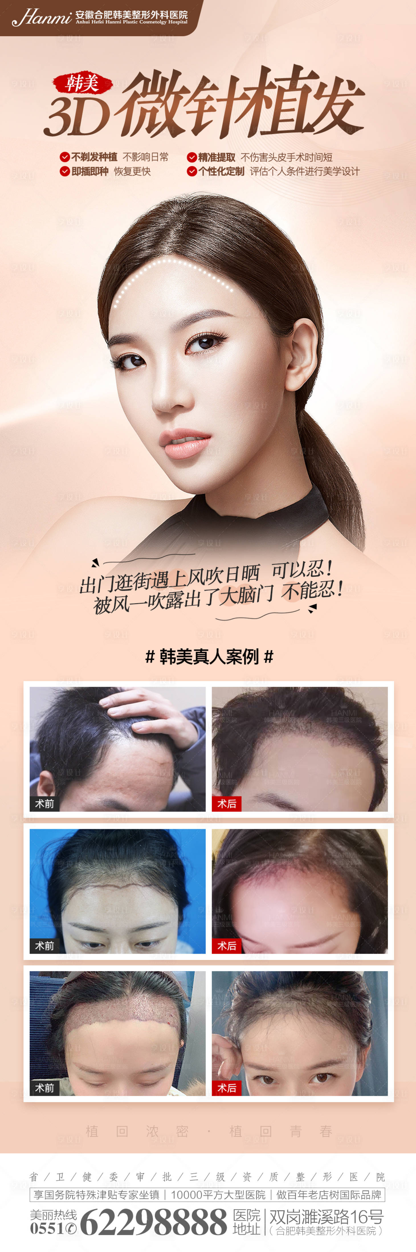 源文件下载【享设计】搜索编号：40400007958768974【微针植发】