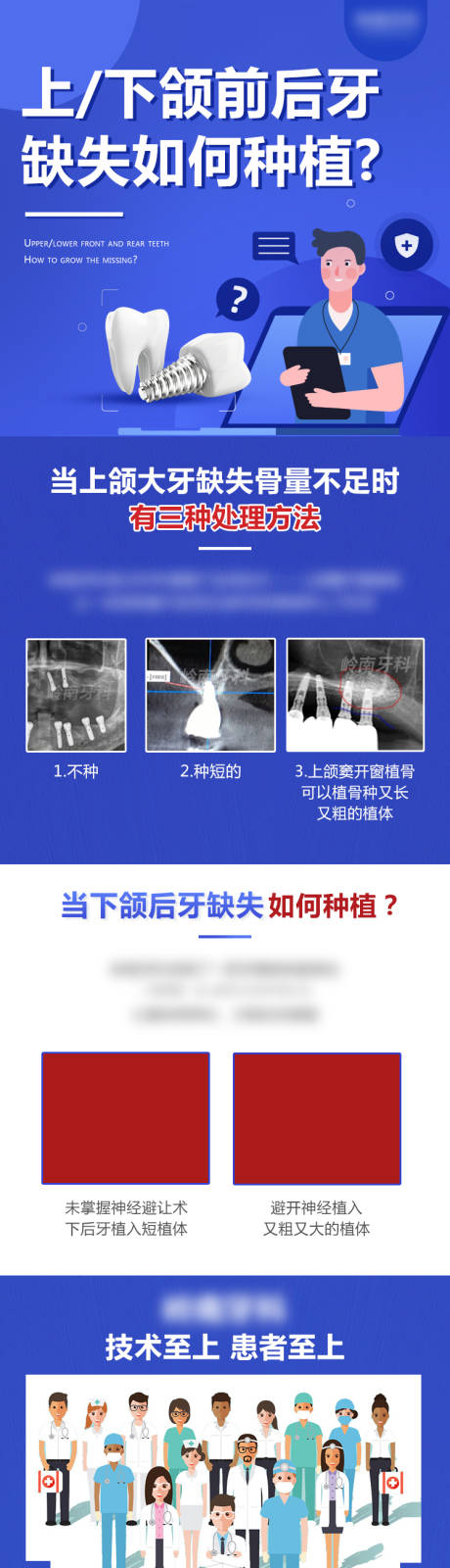 源文件下載【種植牙長圖海報】編號：85650008112327465