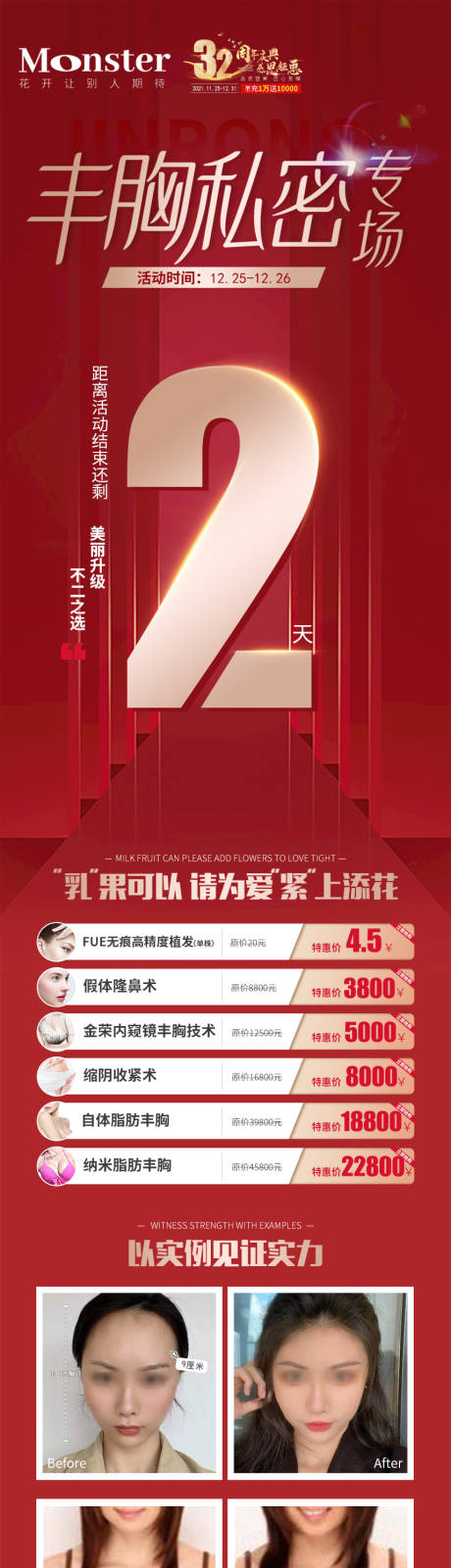 源文件下载【医美丰胸私密倒计时专题】编号：14850007927429092