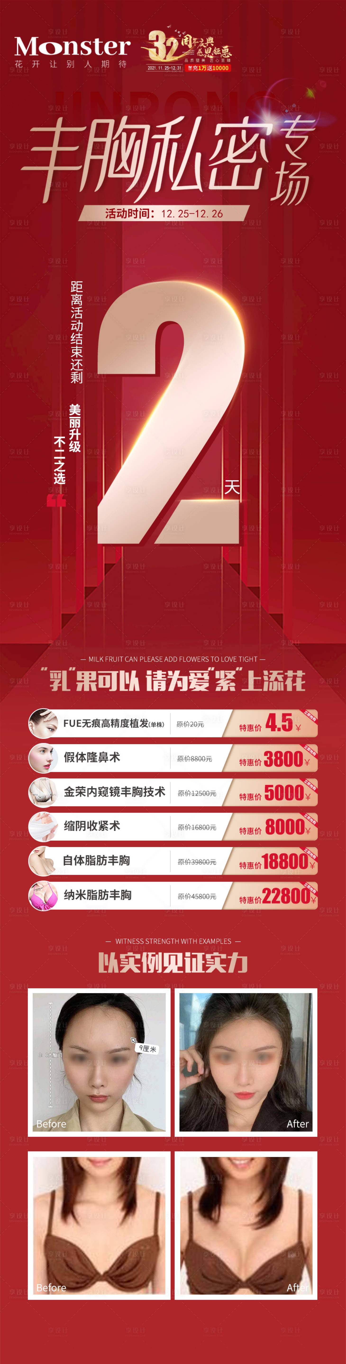 源文件下载【医美丰胸私密倒计时专题】编号：14850007927429092
