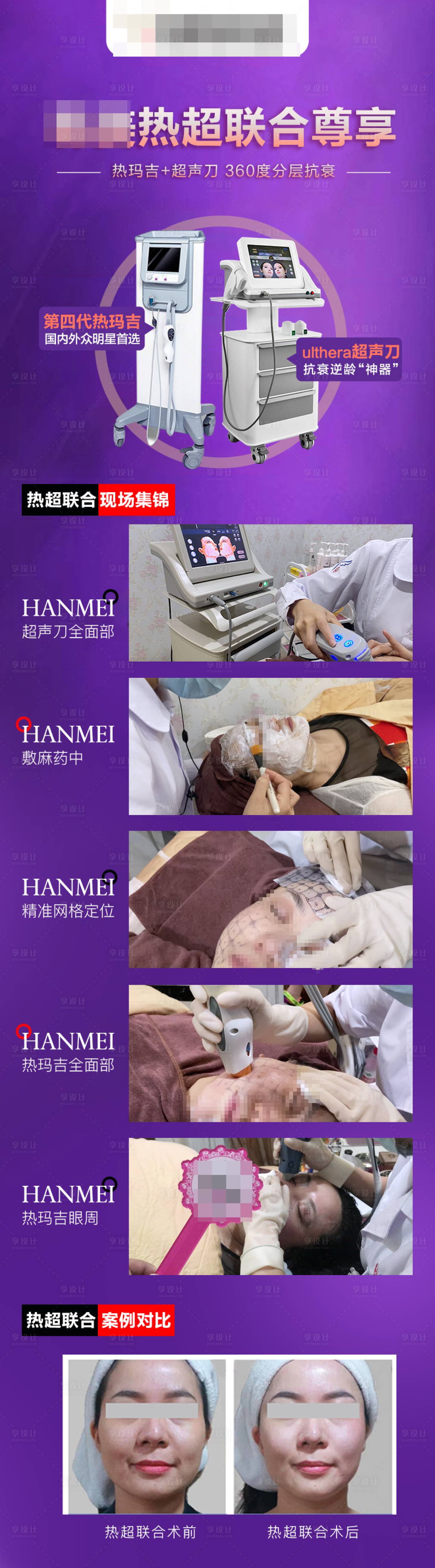 源文件下载【享设计】搜索编号：46700008060788700【热超联合尊享日】
