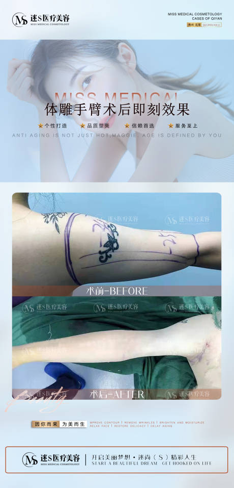 源文件下载【享设计】搜索编号：56640008119401900【医美案例对比图  】