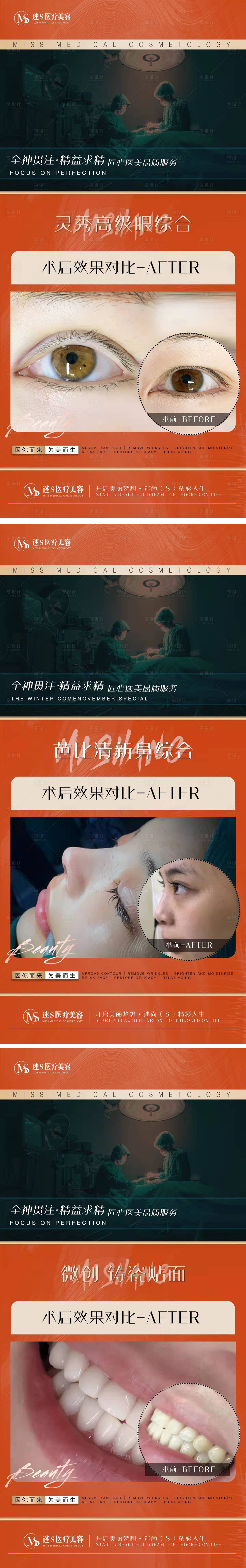 源文件下载【享设计】搜索编号：68500008129548155【医美案例对比系列海报】