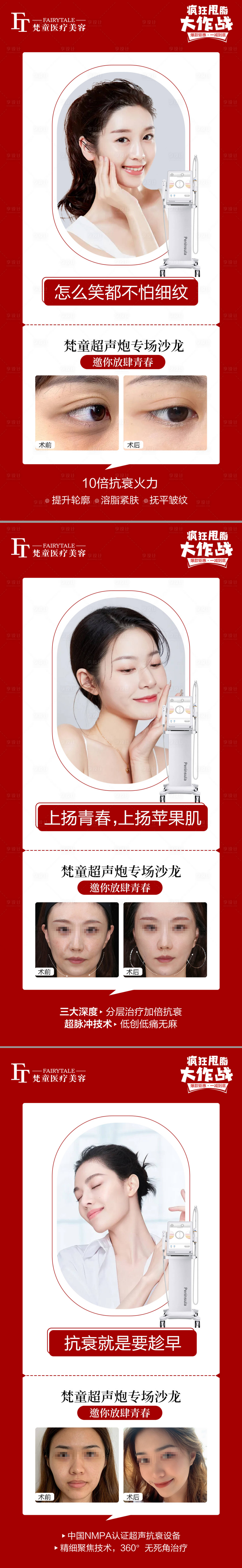 源文件下载【享设计】搜索编号：99250007986835054【超声炮系列海报】