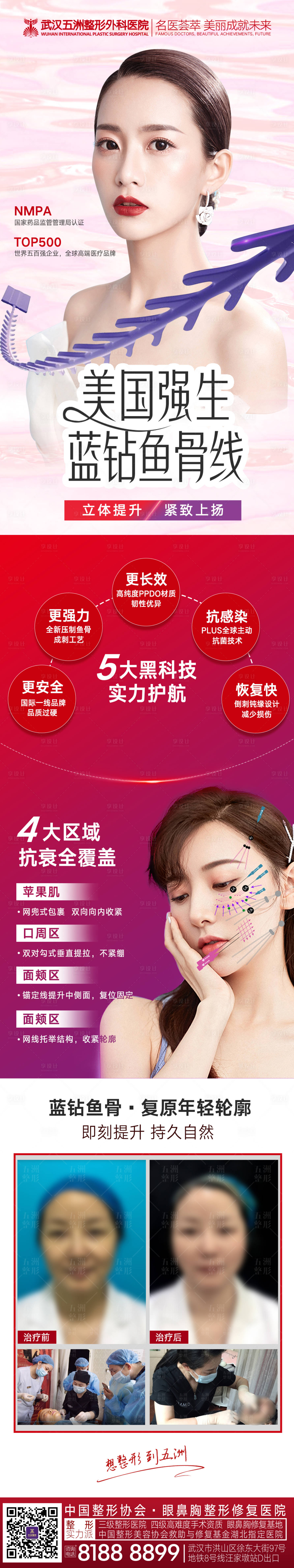源文件下载【医美强生鱼骨线线雕产品详情页】编号：17990008213114106