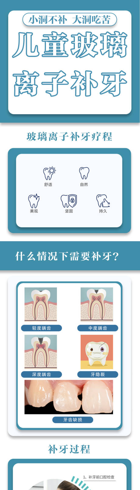 源文件下载【牙科儿童玻璃离子补牙】编号：20220106122823362