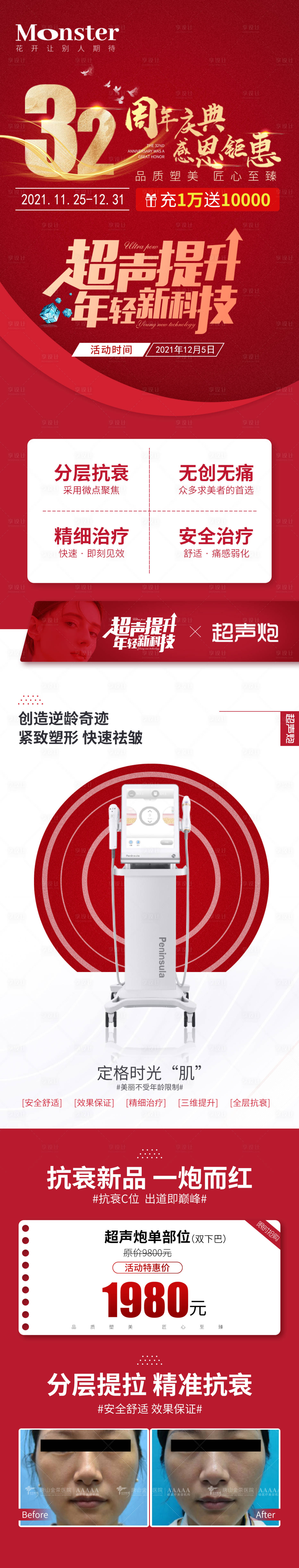 源文件下载【医美超声炮专题长图】编号：68220007926976048