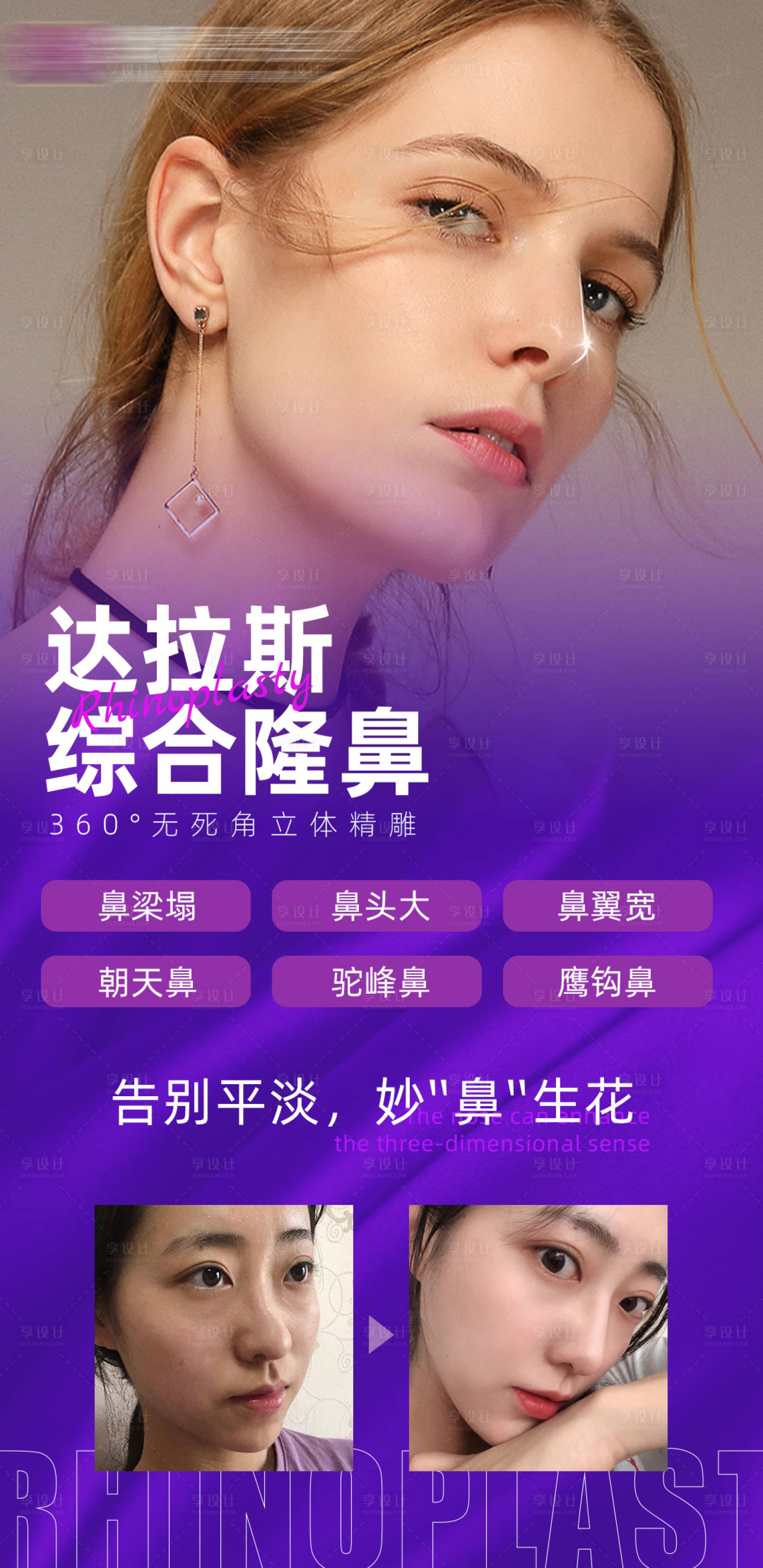 源文件下载【享设计】搜索编号：45760008254961785【医美鼻综合隆鼻宣传海报】