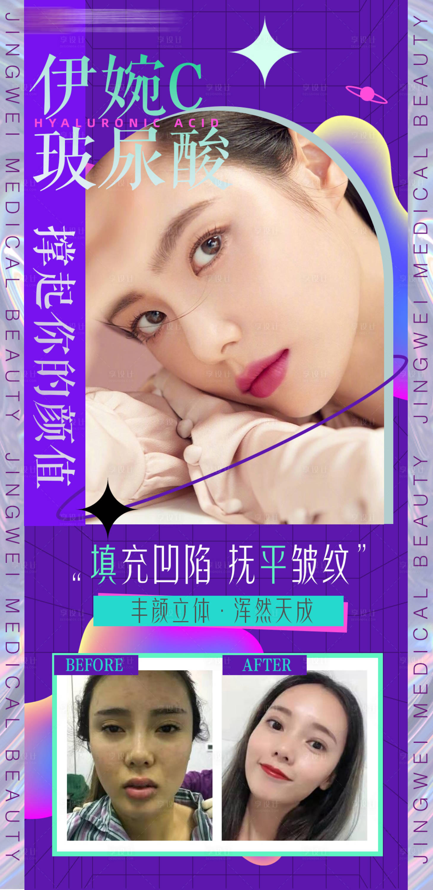 源文件下载【享设计】搜索编号：72810008158844774【医美伊婉玻尿酸宣传海报】